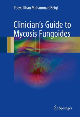 Khan Mohammad Beigi |  Clinician's Guide to Mycosis Fungoides | Buch |  Sack Fachmedien