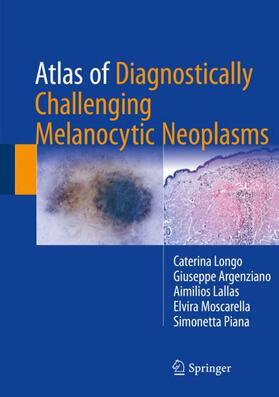 Longo / Argenziano / Piana |  Atlas of Diagnostically Challenging Melanocytic Neoplasms | Buch |  Sack Fachmedien