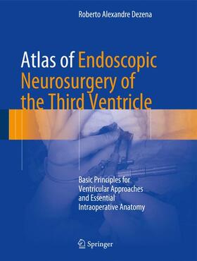 Dezena |  Atlas of Endoscopic Neurosurgery of the Third Ventricle | eBook | Sack Fachmedien