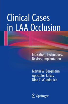 Bergmann / Wunderlich / Tzikas |  Clinical Cases in LAA Occlusion | Buch |  Sack Fachmedien