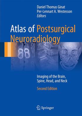 Westesson / Ginat |  Atlas of Postsurgical Neuroradiology | Buch |  Sack Fachmedien