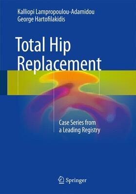 Hartofilakidis / Lampropoulou-Adamidou |  Total Hip Replacement | Buch |  Sack Fachmedien