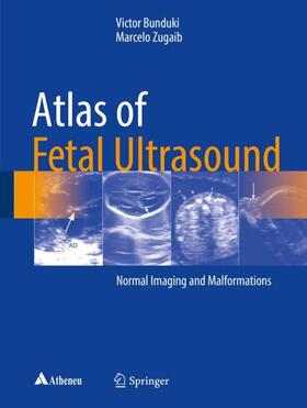 Zugaib / Bunduki |  Atlas of Fetal Ultrasound | Buch |  Sack Fachmedien