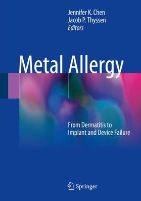 Thyssen / Chen |  Metal Allergy | Buch |  Sack Fachmedien