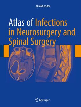 Akhaddar |  Atlas of Infections in Neurosurgery and Spinal Surgery | Buch |  Sack Fachmedien