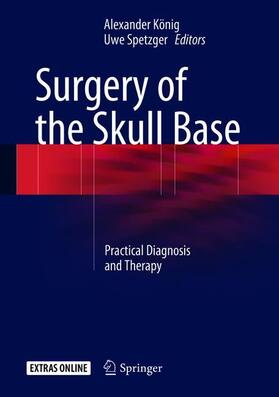 Spetzger / König |  Surgery of the Skull Base | Buch |  Sack Fachmedien