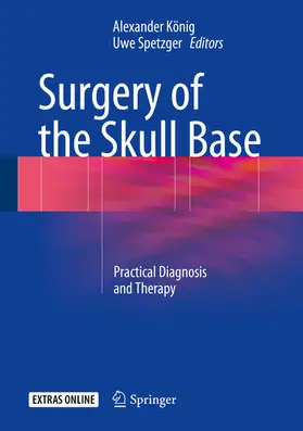 König / Spetzger |  Surgery of the Skull Base | eBook | Sack Fachmedien