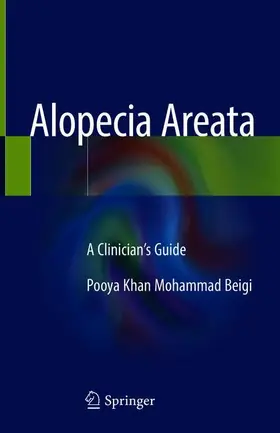 Khan Mohammad Beigi |  Alopecia Areata | Buch |  Sack Fachmedien