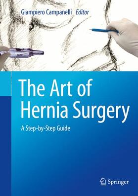 Campanelli |  The Art of Hernia Surgery | Buch |  Sack Fachmedien