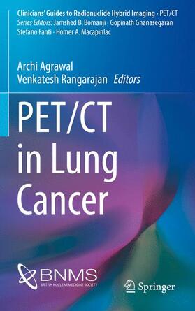 Rangarajan / Agrawal |  PET/CT in Lung Cancer | Buch |  Sack Fachmedien