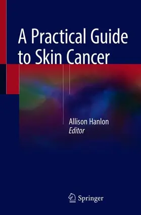 Hanlon |  A Practical Guide to Skin Cancer | Buch |  Sack Fachmedien