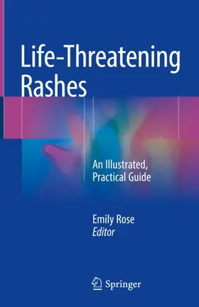 Rose |  Life-Threatening Rashes | Buch |  Sack Fachmedien