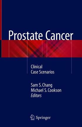 Cookson / Chang |  Prostate Cancer | Buch |  Sack Fachmedien
