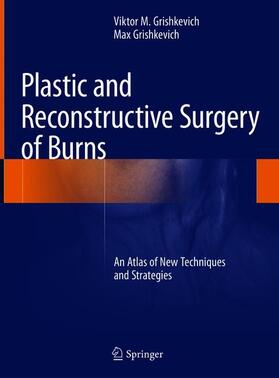 Grishkevich |  Plastic and Reconstructive Surgery of Burns | Buch |  Sack Fachmedien