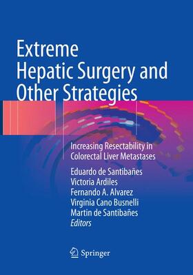 de Santibañes / Ardiles / Alvarez |  Extreme Hepatic Surgery and Other Strategies | Buch |  Sack Fachmedien