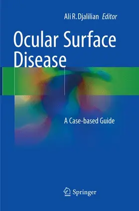 Djalilian |  Ocular Surface Disease | Buch |  Sack Fachmedien