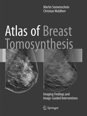 Sonnenschein / Waldherr |  Atlas of Breast Tomosynthesis | Buch |  Sack Fachmedien