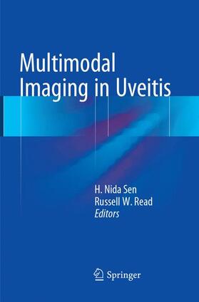Read / Sen |  Multimodal Imaging in Uveitis | Buch |  Sack Fachmedien