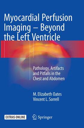 Sorrell / Oates |  Myocardial Perfusion Imaging - Beyond the Left Ventricle | Buch |  Sack Fachmedien