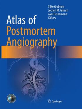 Grabherr / Grimm / Heinemann |  Atlas of Postmortem Angiography | Buch |  Sack Fachmedien