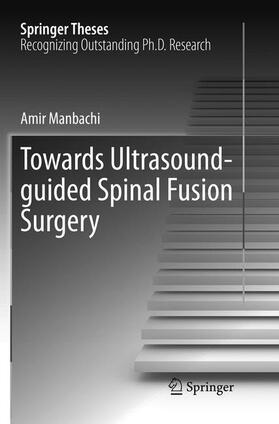 Manbachi |  Towards Ultrasound-guided Spinal Fusion Surgery | Buch |  Sack Fachmedien