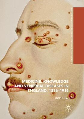 Hanley |  Medicine, Knowledge and Venereal Diseases in England, 1886-1916 | Buch |  Sack Fachmedien