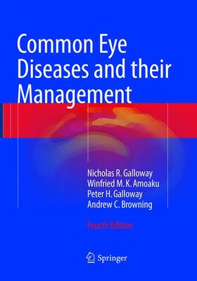 Galloway / Browning / Amoaku |  Common Eye Diseases and their Management | Buch |  Sack Fachmedien