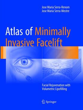 Serra-Mestre / Serra-Renom |  Atlas of Minimally Invasive Facelift | Buch |  Sack Fachmedien