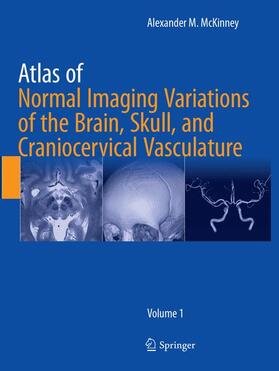 McKinney |  Atlas of Normal Imaging Variations of the Brain, Skull, and Craniocervical Vasculature | Buch |  Sack Fachmedien