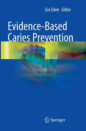 Eden |  Evidence-Based Caries Prevention | Buch |  Sack Fachmedien