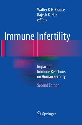 Naz / Krause |  Immune Infertility | Buch |  Sack Fachmedien