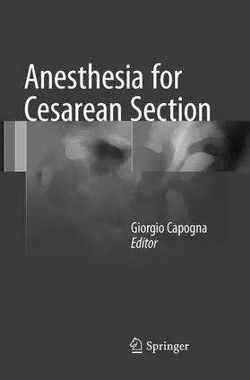 Capogna |  Anesthesia for Cesarean Section | Buch |  Sack Fachmedien