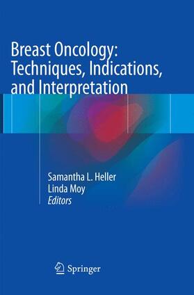 Moy / Heller |  Breast Oncology: Techniques, Indications, and Interpretation | Buch |  Sack Fachmedien