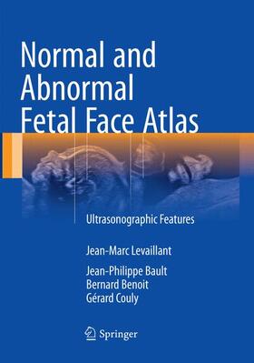 Levaillant / Bault / Benoit |  Normal and Abnormal Fetal Face Atlas | Buch |  Sack Fachmedien