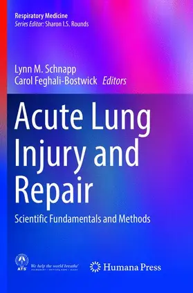 Feghali-Bostwick / Schnapp |  Acute Lung Injury and Repair | Buch |  Sack Fachmedien