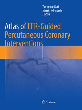 Fineschi / Gori |  Atlas of FFR-Guided Percutaneous Coronary Interventions | Buch |  Sack Fachmedien
