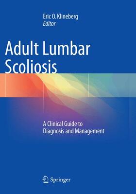 Klineberg |  Adult Lumbar Scoliosis | Buch |  Sack Fachmedien