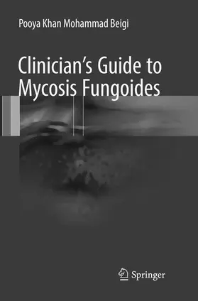 Khan Mohammad Beigi |  Clinician's Guide to Mycosis Fungoides | Buch |  Sack Fachmedien