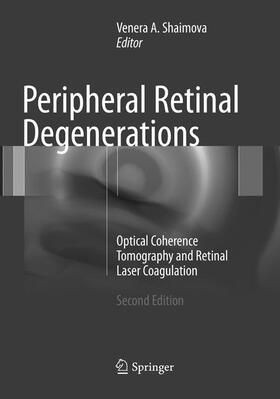 Shaimova |  Peripheral Retinal Degenerations | Buch |  Sack Fachmedien