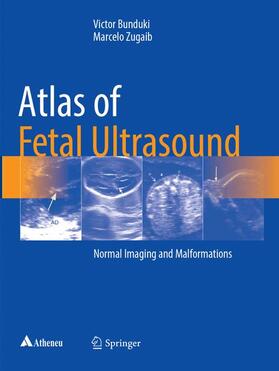 Zugaib / Bunduki |  Atlas of Fetal Ultrasound | Buch |  Sack Fachmedien