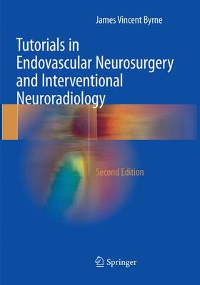 Byrne |  Tutorials in Endovascular Neurosurgery and Interventional Neuroradiology | Buch |  Sack Fachmedien
