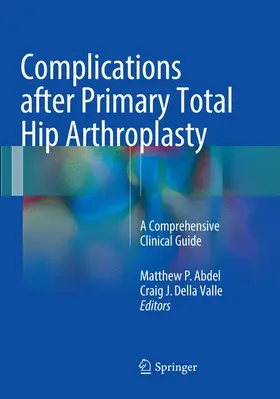 Della Valle / Abdel |  Complications after Primary Total Hip Arthroplasty | Buch |  Sack Fachmedien