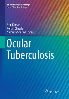 Kumar / Sharma / Chawla |  Ocular Tuberculosis | Buch |  Sack Fachmedien