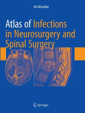 Akhaddar |  Atlas of Infections in Neurosurgery and Spinal Surgery | Buch |  Sack Fachmedien