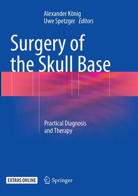 Spetzger / König |  Surgery of the Skull Base | Buch |  Sack Fachmedien