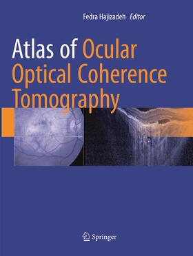 Hajizadeh |  Atlas of Ocular Optical Coherence Tomography | Buch |  Sack Fachmedien