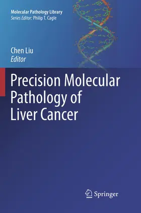 Liu |  Precision Molecular Pathology of Liver Cancer | Buch |  Sack Fachmedien