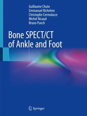 Chuto / Richelme / Puech |  Bone SPECT/CT of Ankle and Foot | Buch |  Sack Fachmedien