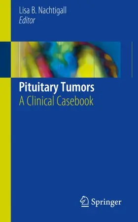 Nachtigall |  Pituitary Tumors | Buch |  Sack Fachmedien