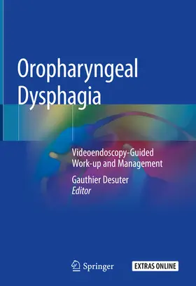 Desuter |  Oropharyngeal Dysphagia | eBook | Sack Fachmedien